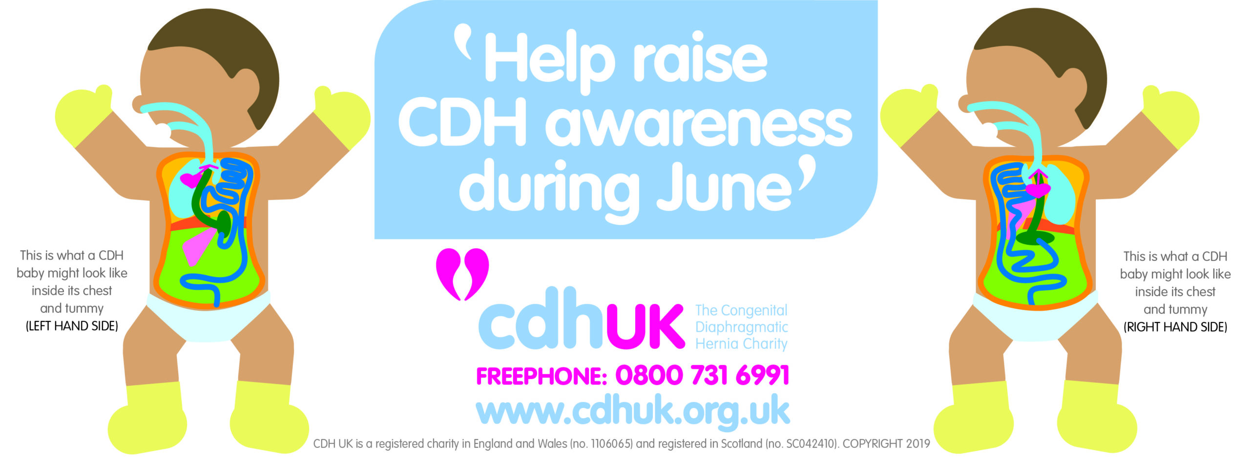 June is CDH Awareness Month Join in June 4 CDH! CDH UK